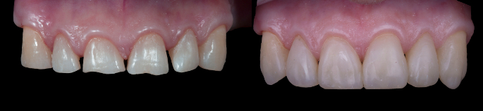 foto-2 foto-2