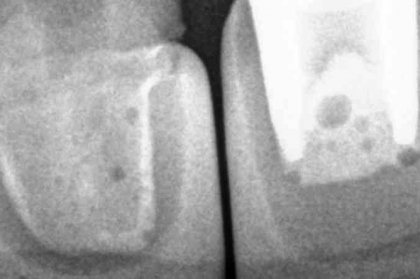 Endodontia: Diagnóstico e tratamento em endodontia (1º módulo, Lisboa)