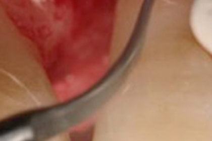 Diagnóstico e terapêutica em periodontologia (Ponta Delgada)