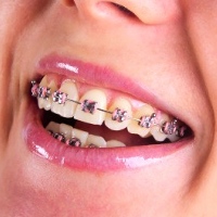 Reconhecimento de curso de especialização em ortodontia