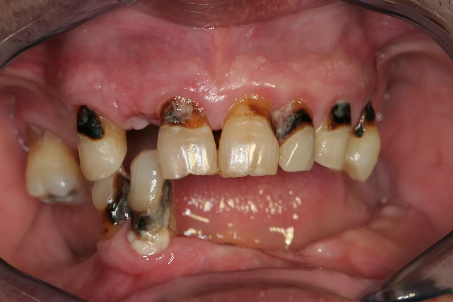 Saúde oral sénior - foto 1