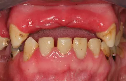 Saúde oral sénior - foto 2