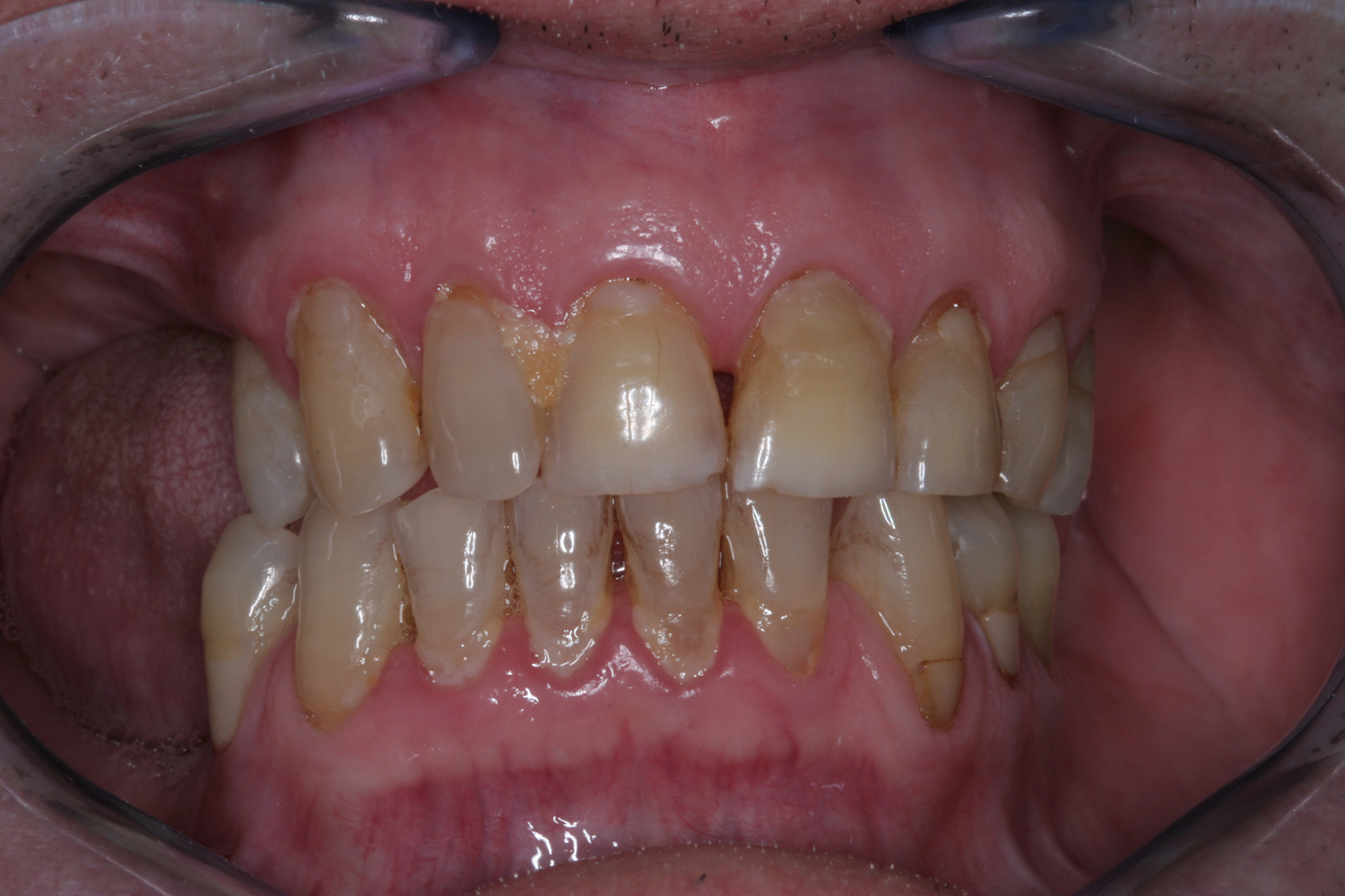 Saúde oral sénior - foto 8