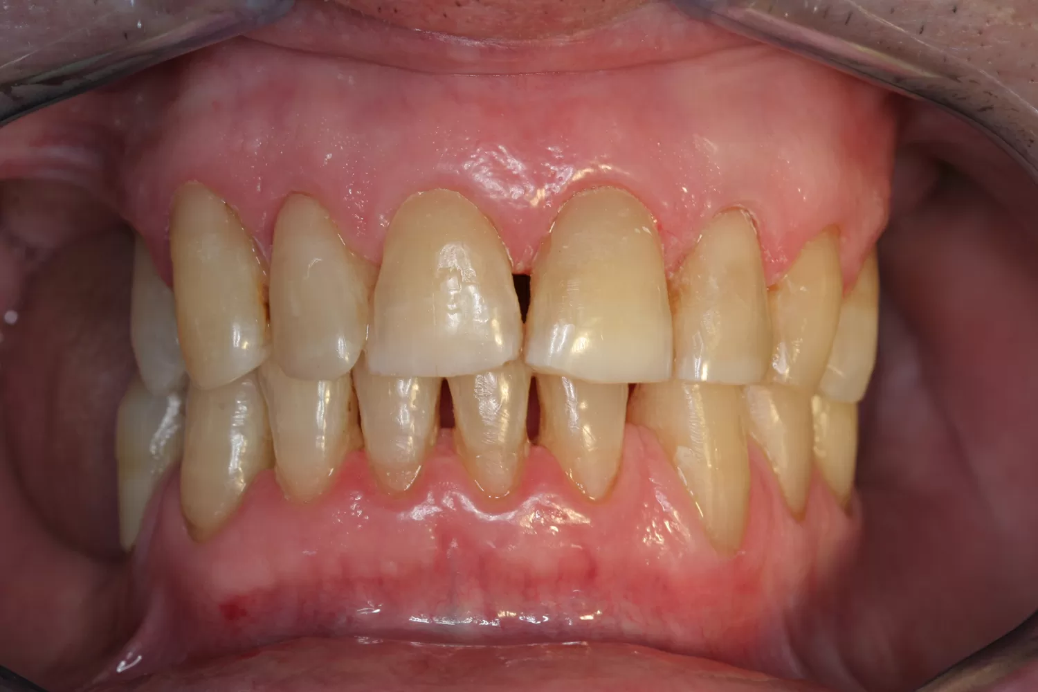 Saúde oral sénior - foto 9