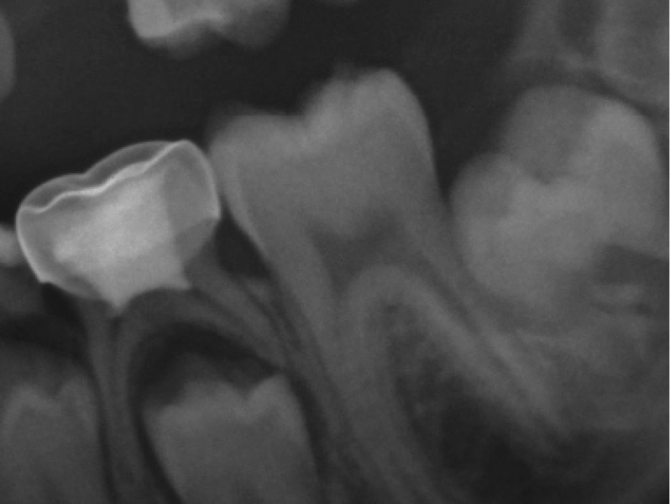 20130617-caso1-v2