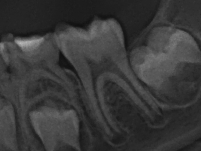 20130617-caso2-v2