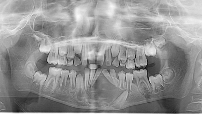 20130708-caso1 20130708-caso1