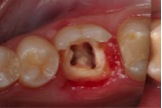 foto-1