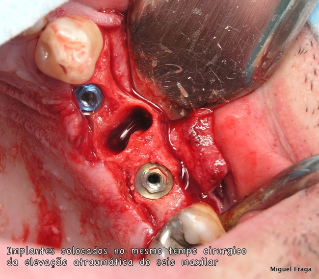 c015-003-webimg650px