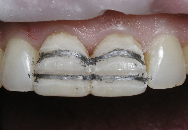 c016-004-webimg650p4