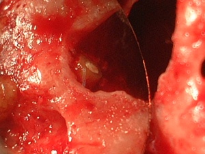 caso-20120326