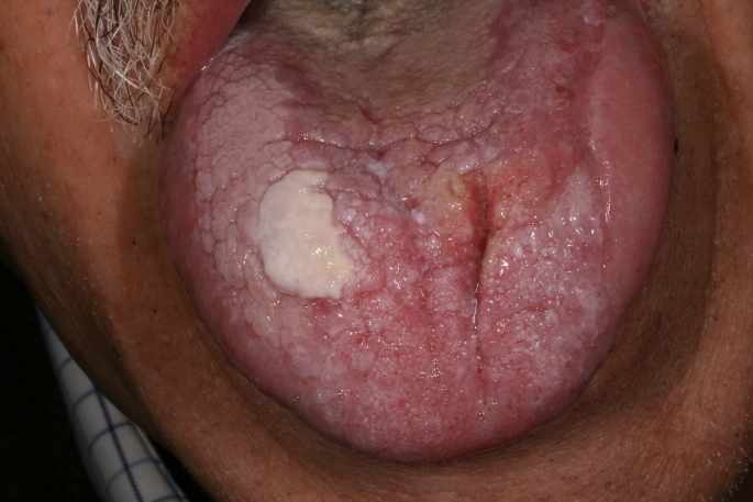 foto-1