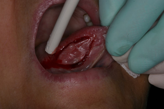 foto-2