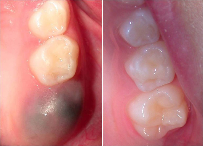 foto-3