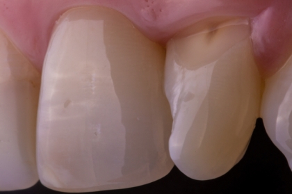 Curso fotografia em medicina dentária