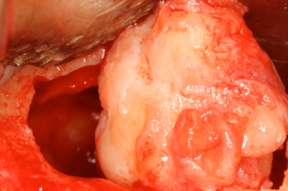 A cirurgia oral na prática clínica diária