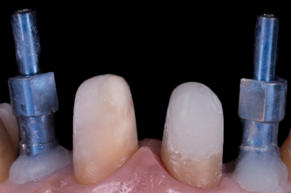 Reabilitação de casos complexos: uma abordagem multidisciplinar