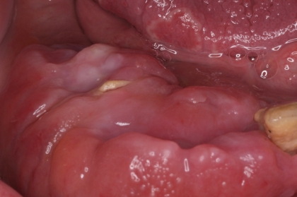 Medicina e patologia oral - diagnóstico e terapêutica