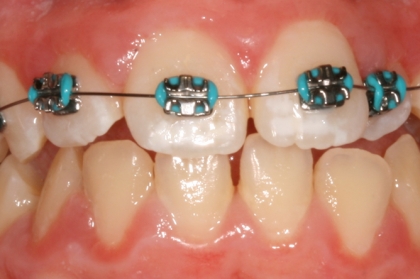 Assistente dentário: Ortodontia e implantologia (Funchal)