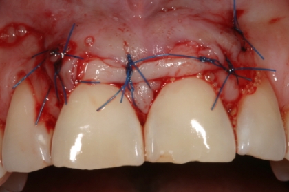 Atualização em periodontologia