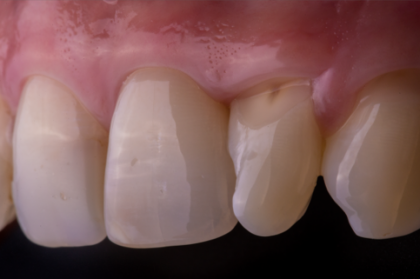 Curso teórico-prático de fotografia em medicina dentária