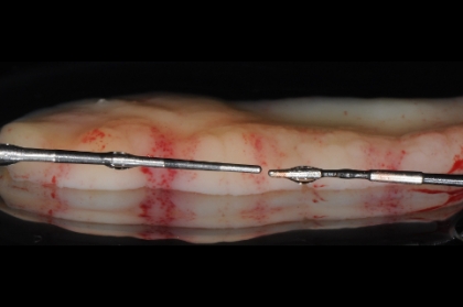 Gestão de tecidos moles em periodontologia e implantologia - conceitos atuais (streaming)