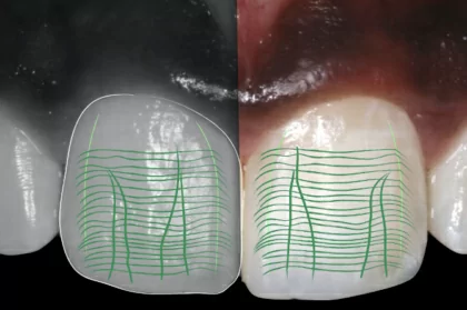 Dentisteria hands-on (4º módulo, data 1, streaming)