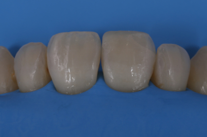 Porquê e como. O isolamento absoluto em medicina dentária