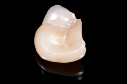 Dentisteria: Restaurações semi-diretas (3º módulo, streaming)