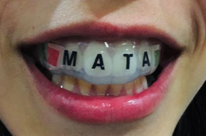 Medicina dentária no desporto: da fisiologia à traumatologia