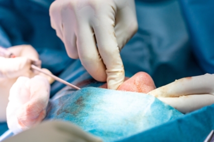 Hands-on de patologia sinusal e cirurgia na comunicação oro-antral com inscrições abertas