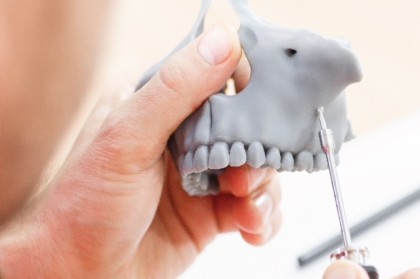 Hands-on sobre mini-implantes no tratamento ortodôntico com inscrições abertas