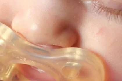 Odontopediatria em bebés