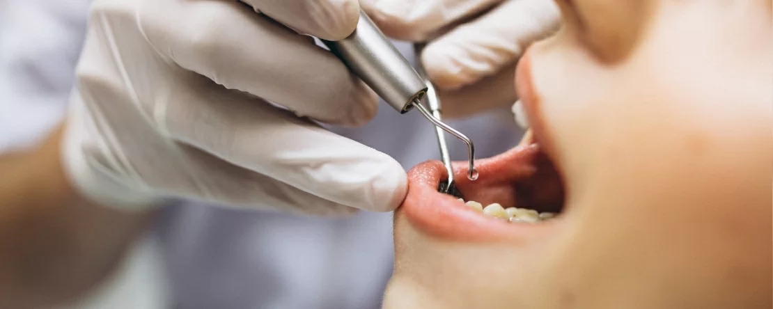 Governo atualiza valor do cheque-dentista para 45 euros