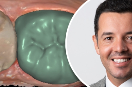 Curso presencial: inovações em prostodontia fixa (últimas vagas)