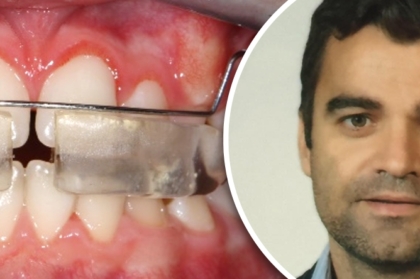 Vídeo do curso clínico com Duarte Senra disponível para visualização