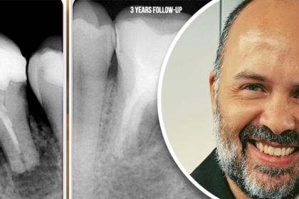 Vídeo do curso clínico com Hugo Sousa Dias disponível para visualização