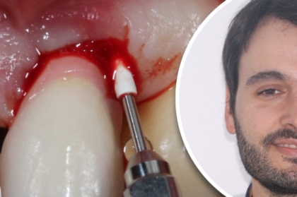 Vídeo do curso clínico com Gonçalo Assis disponível para visualização