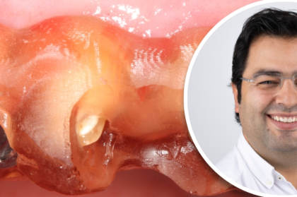 Vídeo do curso clínico com André Correia disponível para visualização