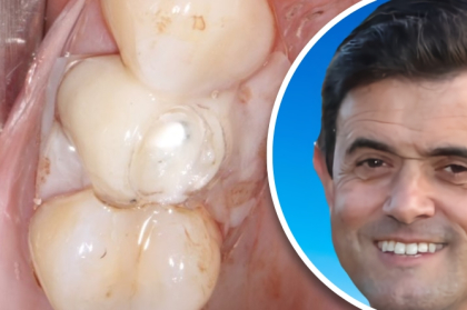 Vídeo do curso clínico com Manuel Francisco disponível para visualização