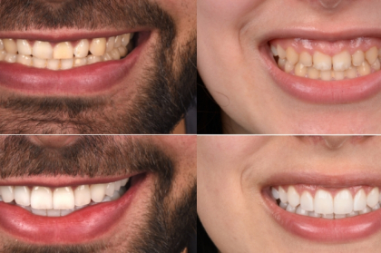 Planeamento interdisciplinar em reabilitação oral (Funchal)