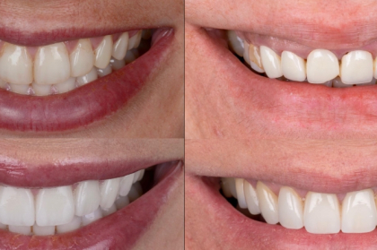 Planeamento interdisciplinar em reabilitação oral (Ponta Delgada)