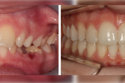 Planeamento ortodôntico multidisciplinar