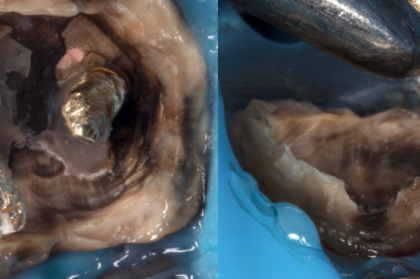 Retenção intra-radicular: quando e como usar?