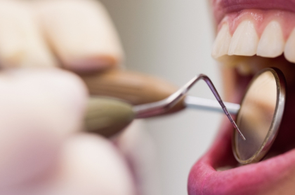 CED emite orientações para médicos dentistas sobre a prática clínica