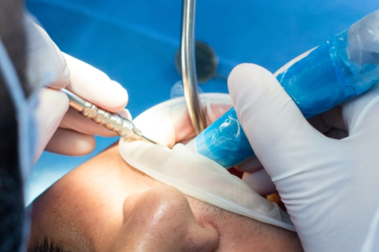 Governo aprova novas especialidades de endodontia e prostodontia