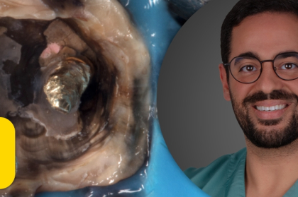 Vídeo do curso "Retenção intra-radicular: quando e como usar?"