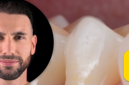 Vídeo do curso “Vertiprep vs. B.O.P.T. - Uma visão clínica e técnico-laboratorial”