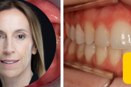 Vídeo do curso "Planeamento ortodôntico multidisciplinar"