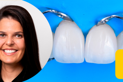 Vídeo do webinar "Estratégias para a reabilitação estética de dentes anteriores"